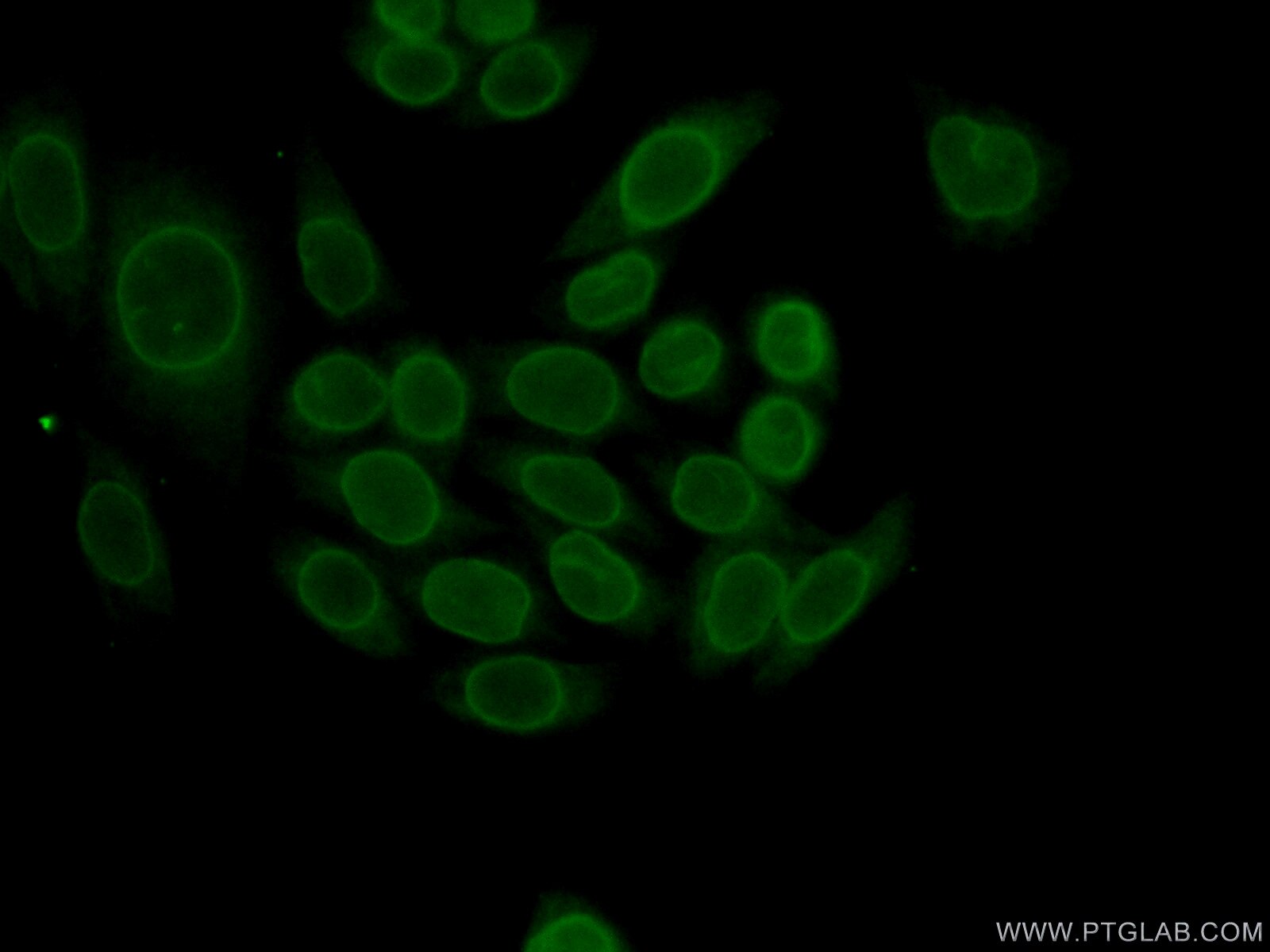 Immunofluorescence (IF) / fluorescent staining of HeLa cells using LBR Polyclonal antibody (12398-1-AP)