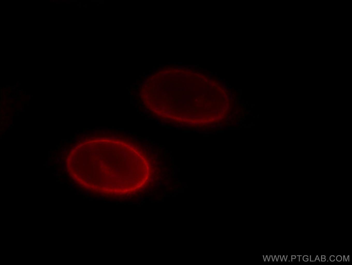 Immunofluorescence (IF) / fluorescent staining of HepG2 cells using LBR Polyclonal antibody (12398-1-AP)