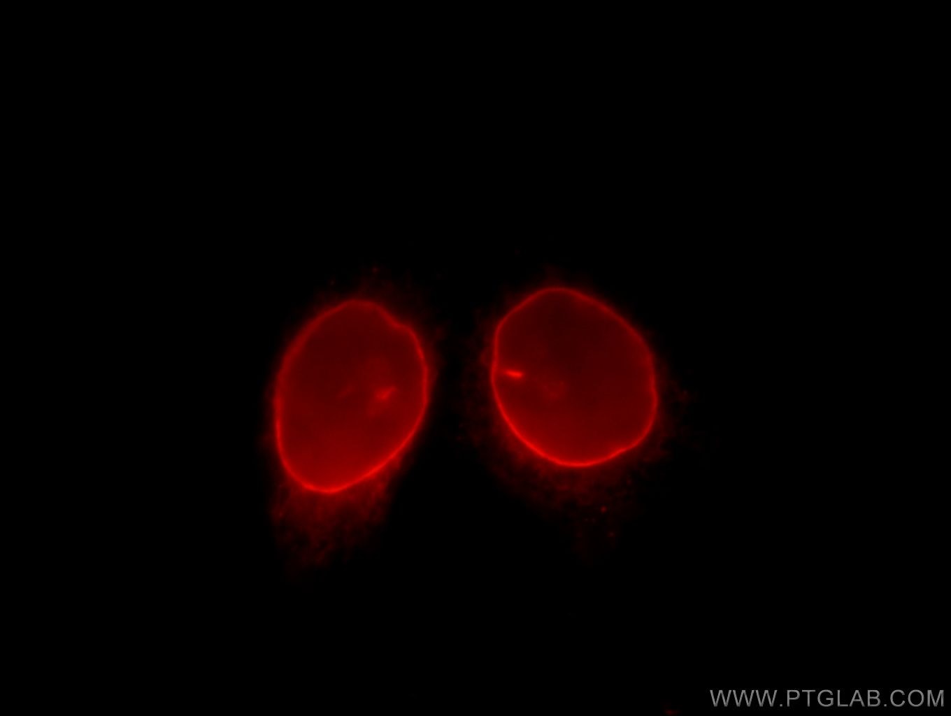 Immunofluorescence (IF) / fluorescent staining of HeLa cells using LBR Polyclonal antibody (12398-1-AP)