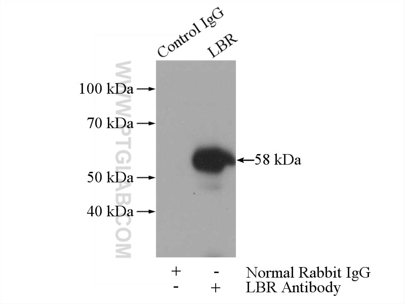 Immunoprecipitation (IP) experiment of A375 cells using LBR Polyclonal antibody (12398-1-AP)