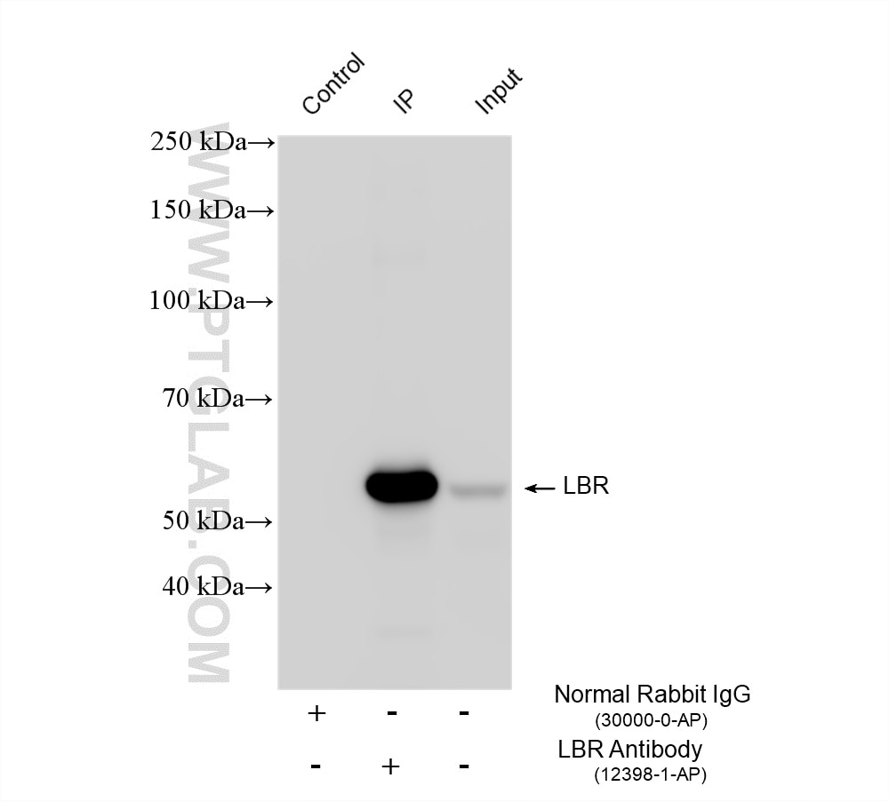Immunoprecipitation (IP) experiment of HeLa cells using LBR Polyclonal antibody (12398-1-AP)