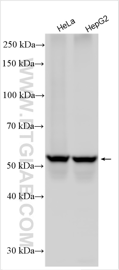 Western Blot (WB) analysis of various lysates using human LBR Polyclonal antibody (12398-1-AP)