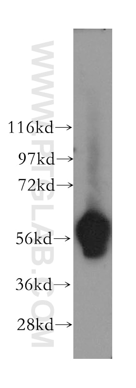 Western Blot (WB) analysis of human brain tissue using LBR Polyclonal antibody (12398-1-AP)