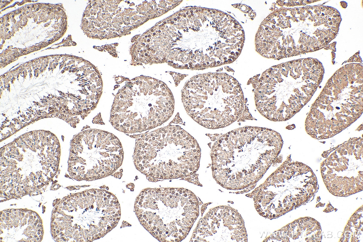 Immunohistochemistry (IHC) staining of mouse testis tissue using LBR Monoclonal antibody (68378-1-Ig)