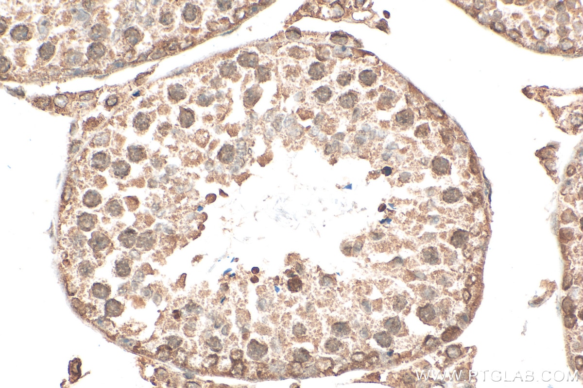 Immunohistochemistry (IHC) staining of mouse testis tissue using LBR Monoclonal antibody (68378-1-Ig)