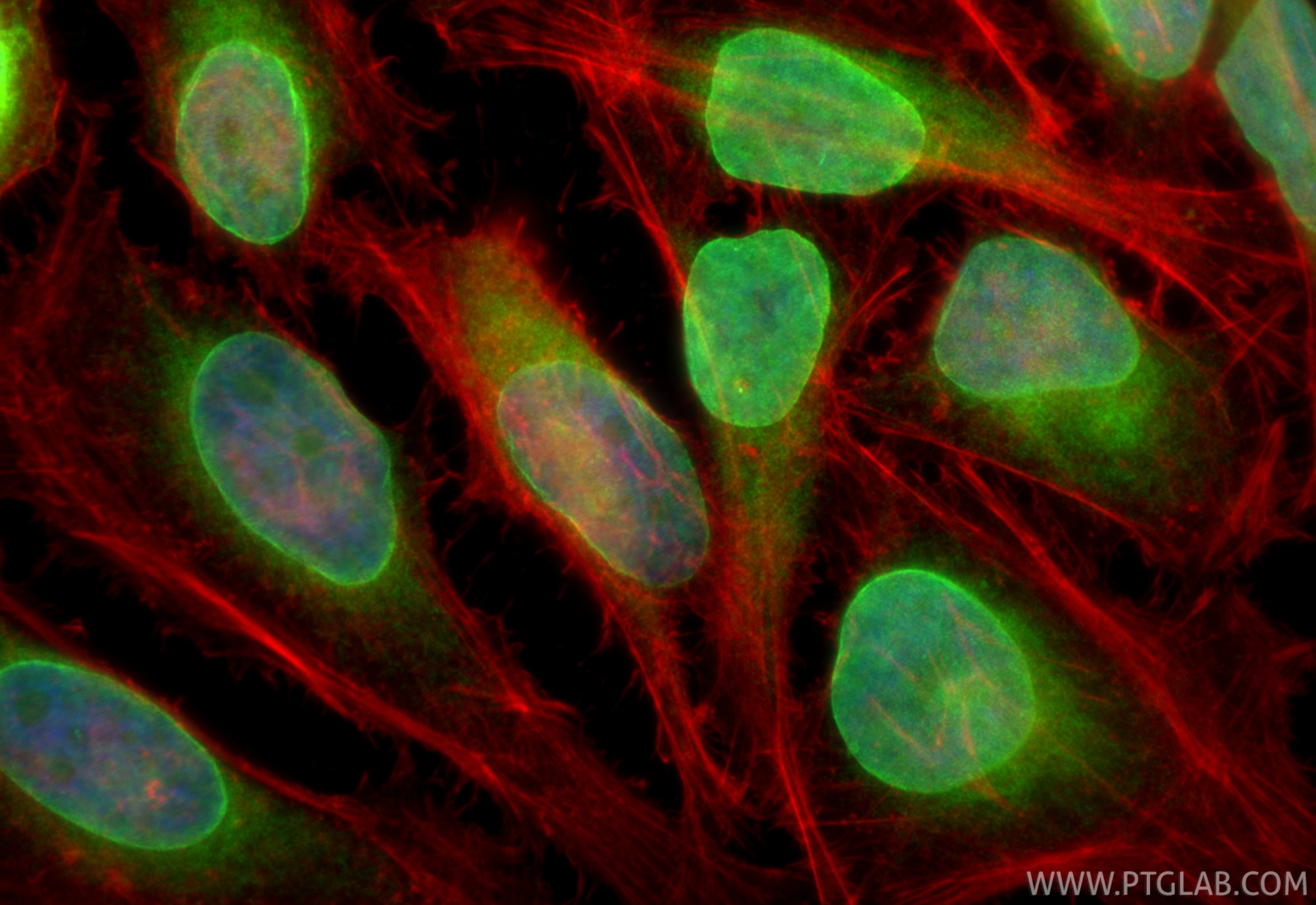 Immunofluorescent analysis of (4% PFA) fixed HeLa cells using LBR antibody (84522-7-RR, Clone: 241864G10 ) at dilution of 1:1000 and CoraLite®488-Conjugated Goat Anti-Rabbit IgG(H+L) (SA00013-2), CL594-Phalloidin (red). This data was developed using the same antibody clone with 84522-7-PBS in a different storage buffer formulation. Immunofluorescence (IF) / fluorescent staining of HeLa cells using LBR Recombinant monoclonal antibody (84522-7-RR)