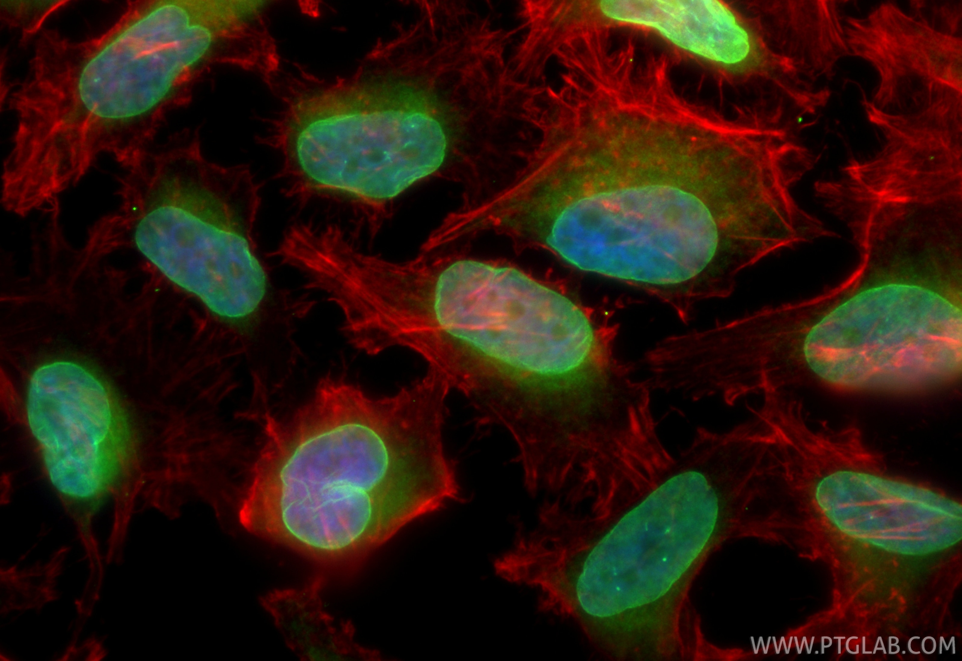 Immunofluorescent analysis of (4% PFA) fixed HeLa cells using CoraLite® Plus 488 LBR antibody (CL488-84522-7, Clone: 241864G10 ) at dilution of 1:200, CL594-Phalloidin (red). Immunofluorescence (IF) / fluorescent staining of HeLa cells using CoraLite® Plus 488-conjugated LBR Recombinant mono (CL488-84522-7)
