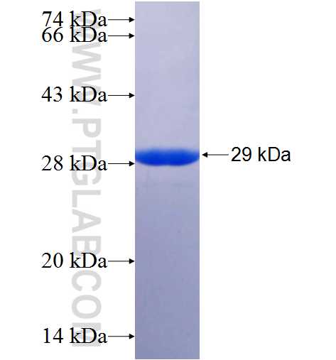 LBR fusion protein Ag25601 SDS-PAGE