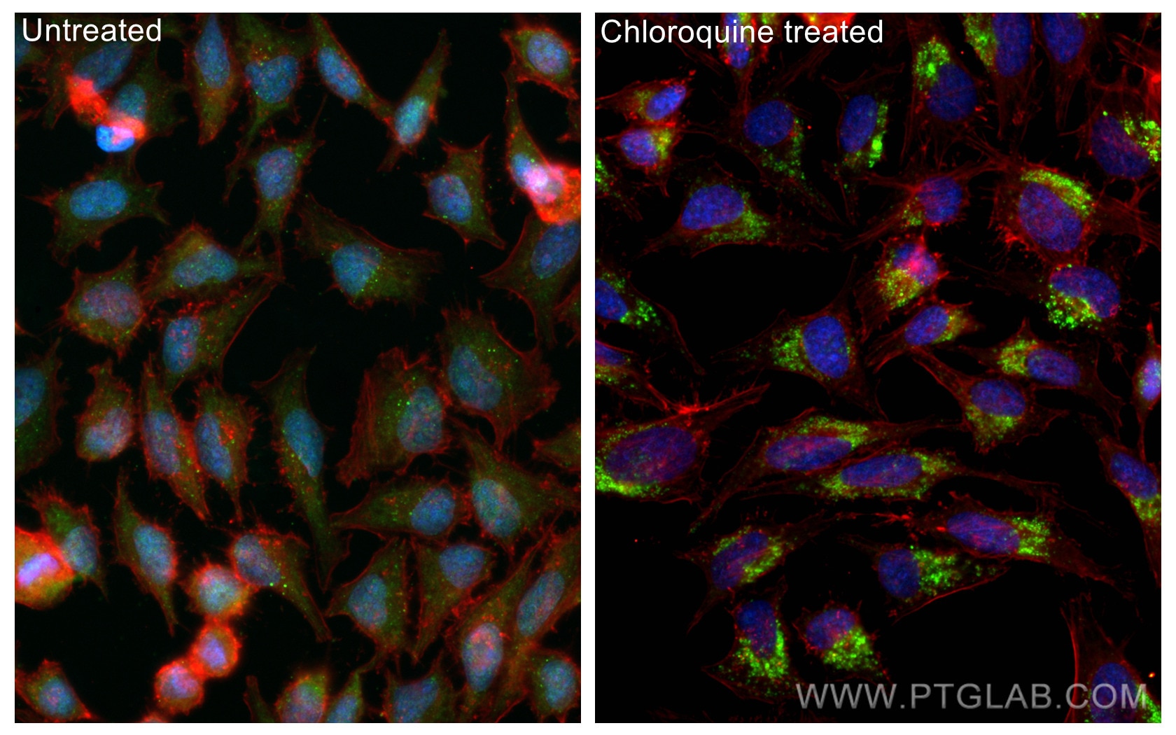 Immunofluorescence (IF) / fluorescent staining of HeLa cells using LC3 Recombinant antibody (81004-1-RR)