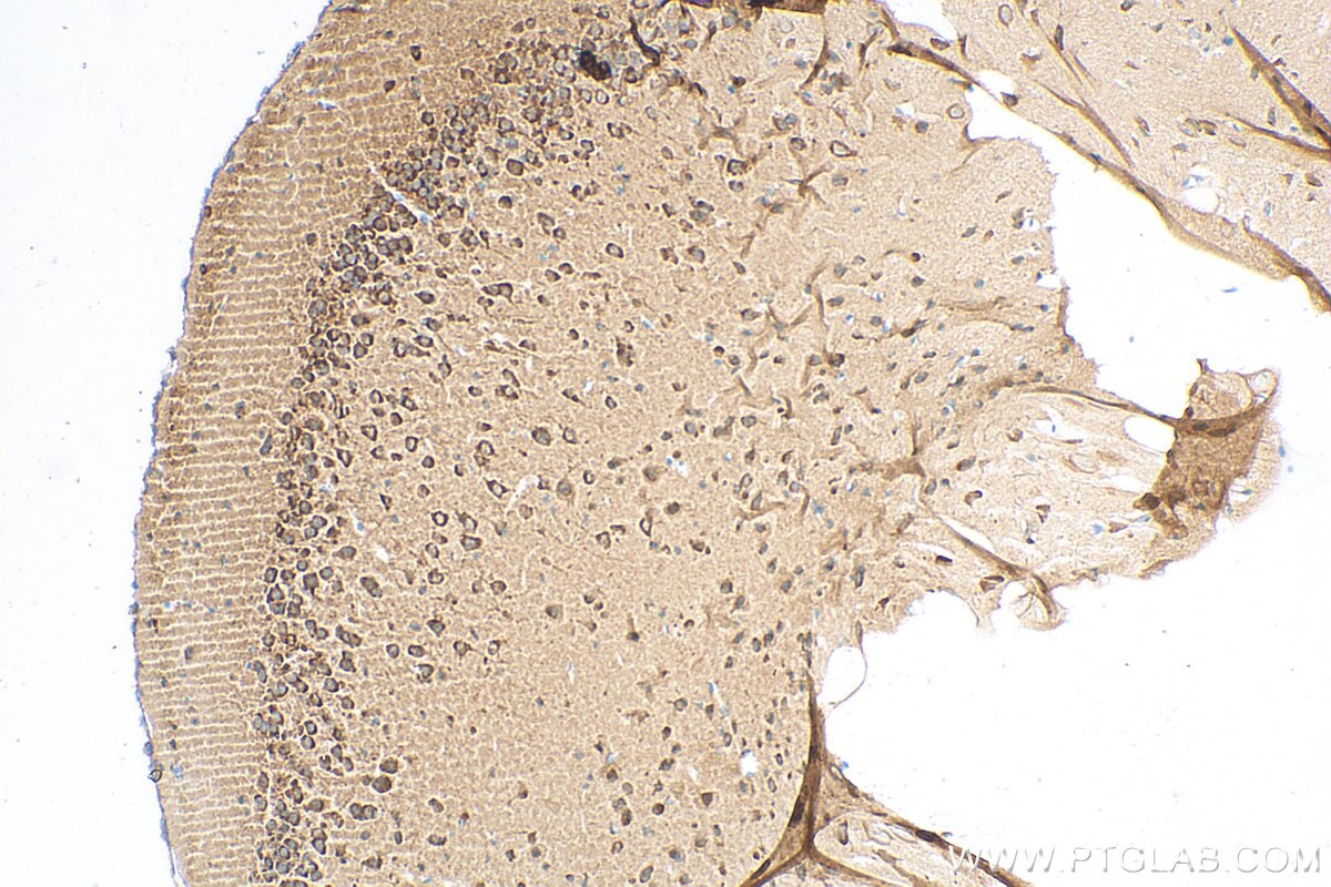 Immunohistochemistry (IHC) staining of mouse brain tissue using LC3 Recombinant antibody (81004-1-RR)