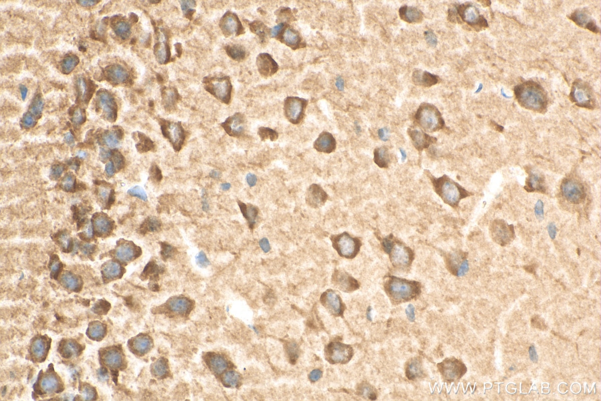 Immunohistochemistry (IHC) staining of mouse brain tissue using LC3 Recombinant antibody (81004-1-RR)