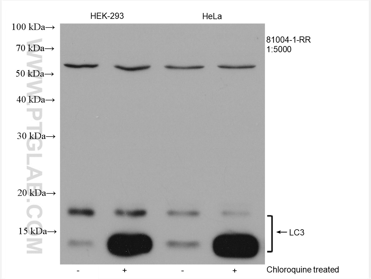 Western Blot (WB) analysis of various lysates using LC3 Recombinant antibody (81004-1-RR)