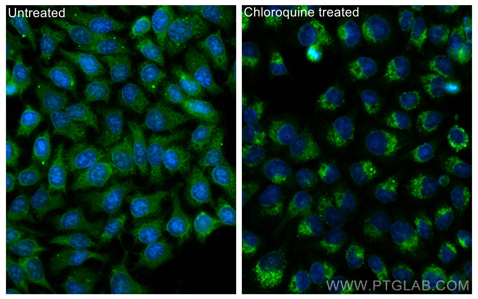 Immunofluorescence (IF) / fluorescent staining of HepG2 cells using CoraLite® Plus 488-conjugated LC3 Polyclonal antib (CL488-14600)