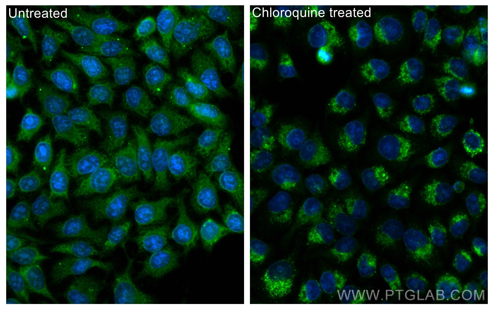 IF Staining of HepG2 using CL488-14600