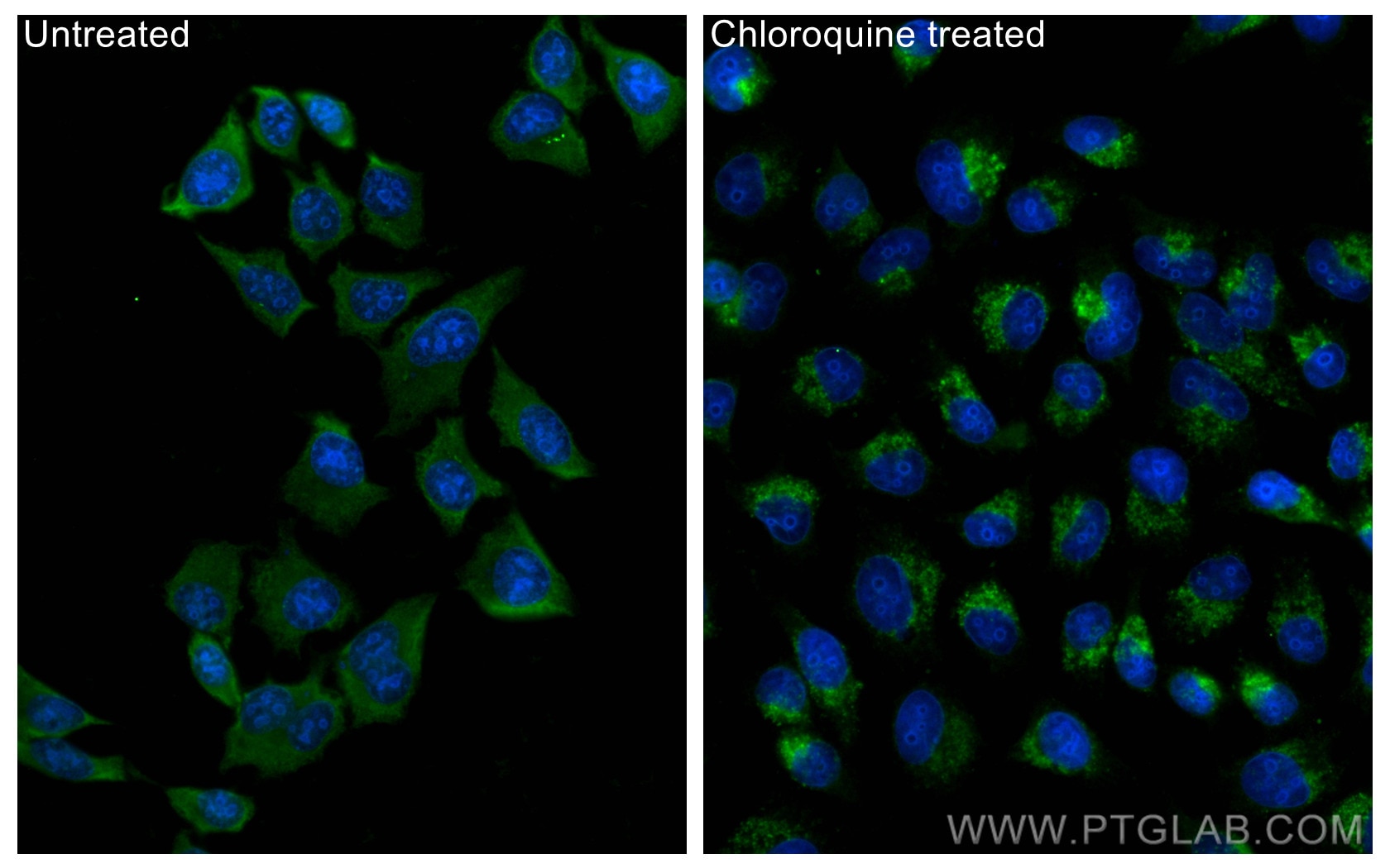 Immunofluorescence (IF) / fluorescent staining of HepG2 cells using CoraLite® Plus 488-conjugated LC3 Polyclonal antib (CL488-14600)