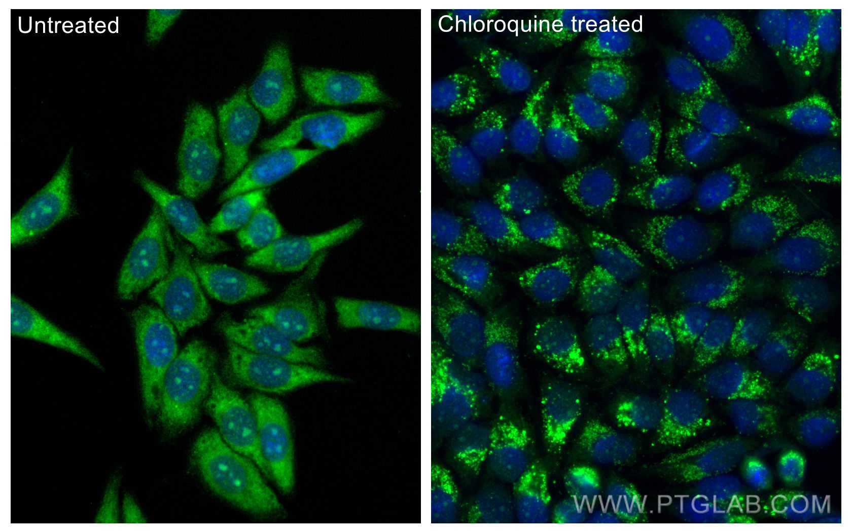 IF Staining of HepG2 using CL488-81004