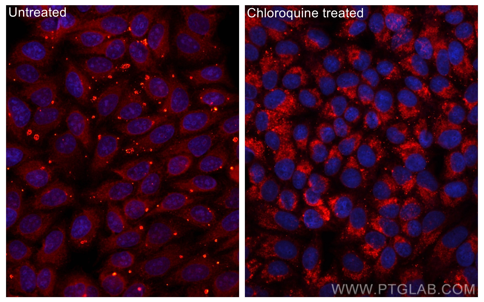 Immunofluorescence (IF) / fluorescent staining of HepG2 cells using CoraLite®594-conjugated LC3 Polyclonal antibody (CL594-14600)