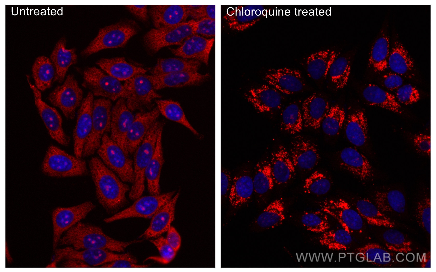 Immunofluorescence (IF) / fluorescent staining of HepG2 cells using CoraLite®594-conjugated LC3 Recombinant antibody (CL594-81004)