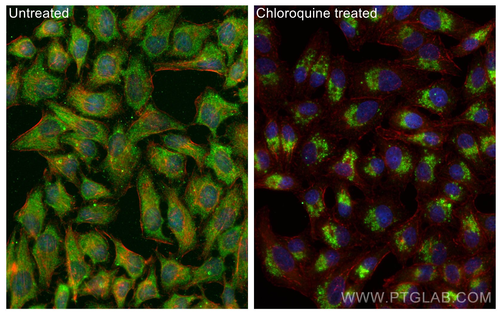 Immunofluorescence (IF) / fluorescent staining of HepG2 cells using CoraLite® Plus 647-conjugated LC3 Polyclonal antib (CL647-14600)