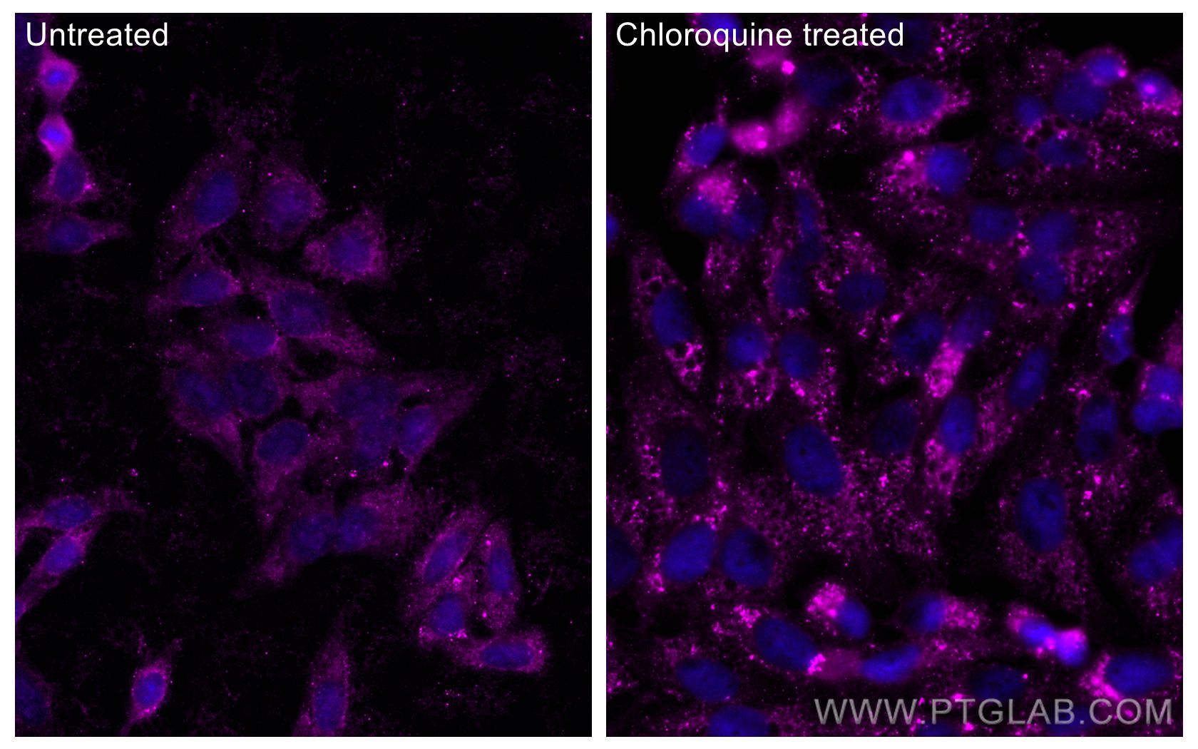 Immunofluorescence (IF) / fluorescent staining of HepG2 cells using CoraLite® Plus 647-conjugated LC3 Polyclonal antib (CL647-14600)