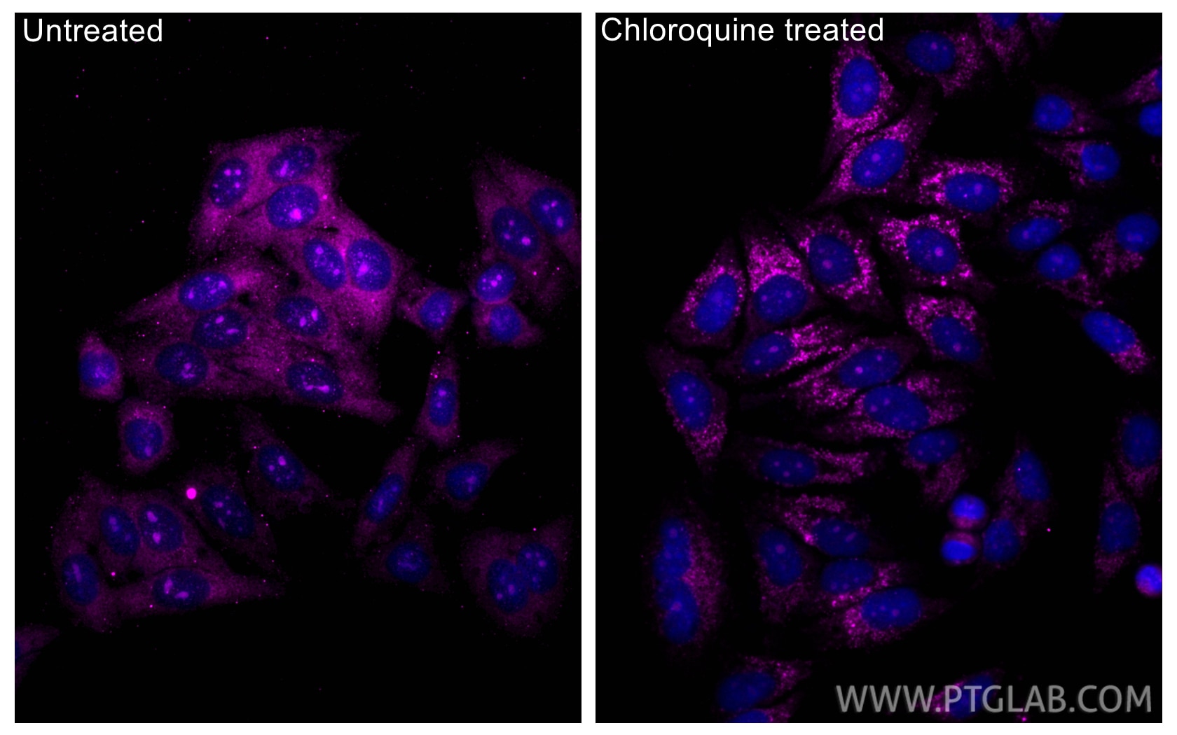 Immunofluorescence (IF) / fluorescent staining of HepG2 cells using CoraLite® Plus 647-conjugated LC3B Recombinant mon (CL647-81004)