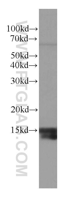 LC3A/B Monoclonal antibody