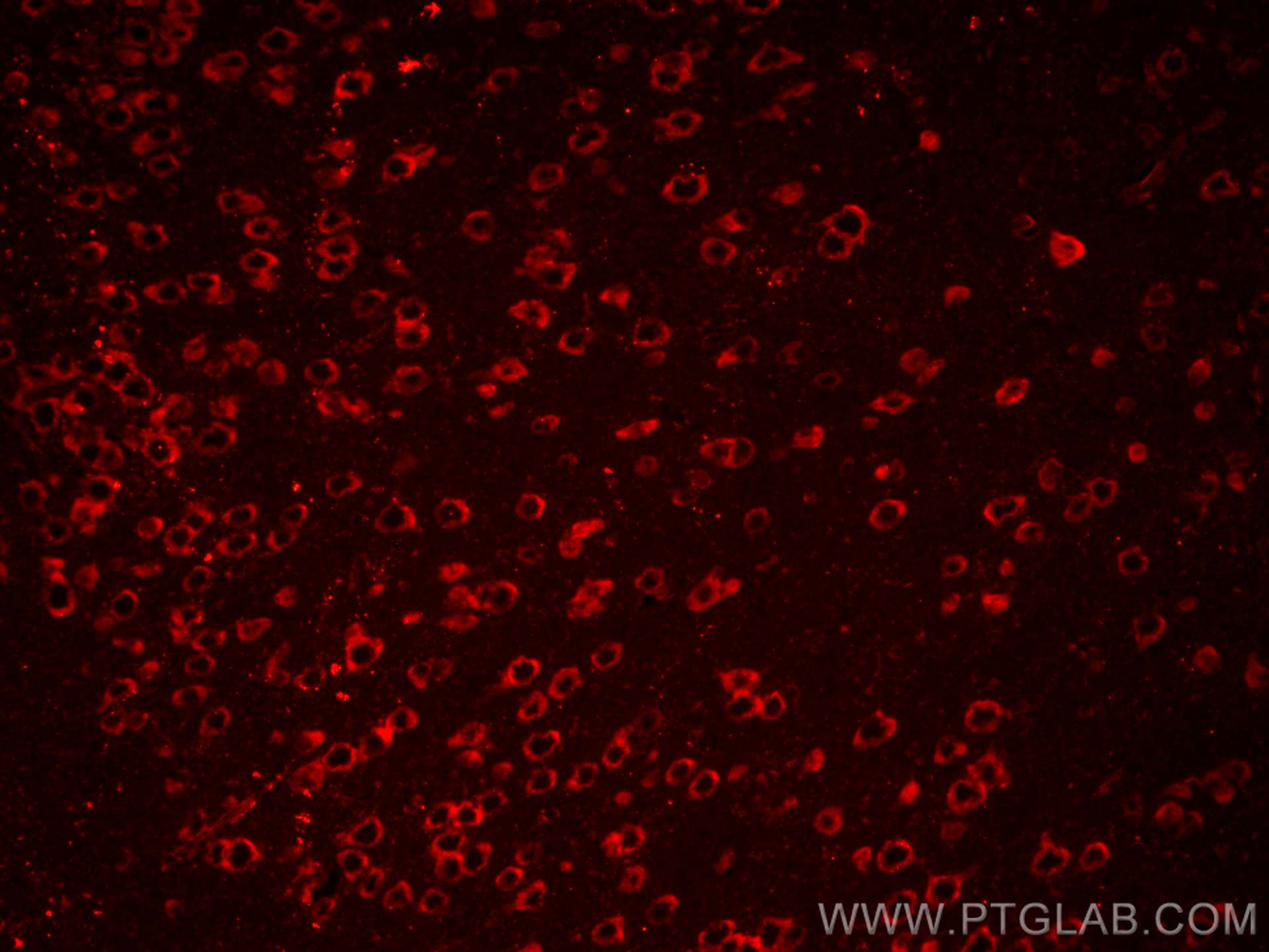 Immunofluorescence (IF) / fluorescent staining of mouse brain tissue using CoraLite®594-conjugated LC3B-Specific Polyclonal a (CL594-18725)