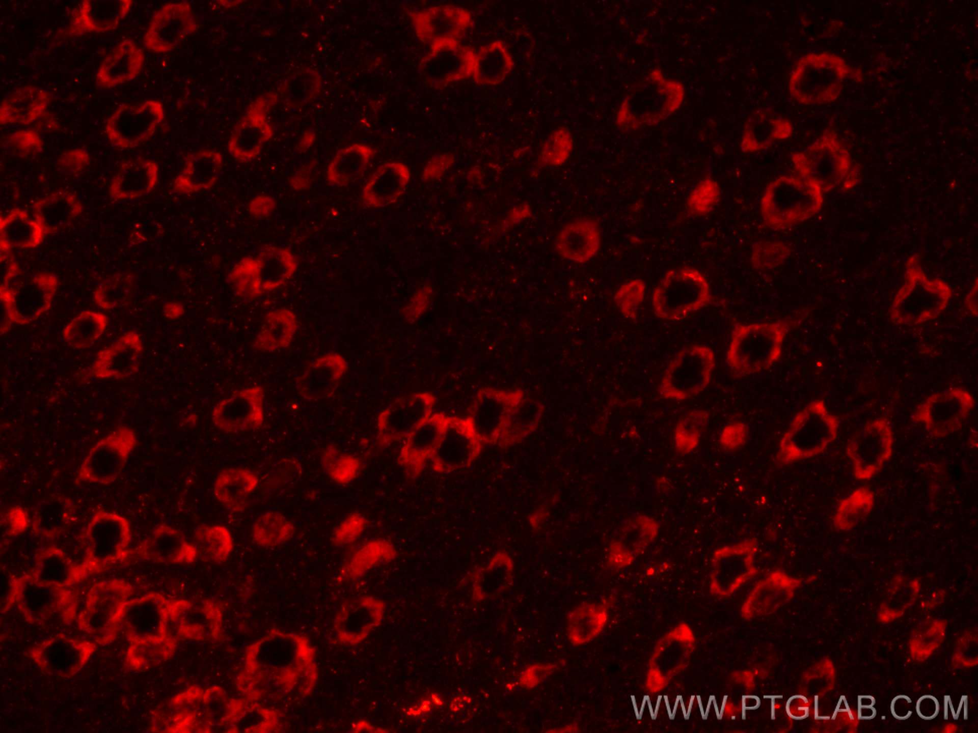 Immunofluorescence (IF) / fluorescent staining of mouse brain tissue using CoraLite®594-conjugated LC3B-Specific Polyclonal a (CL594-18725)
