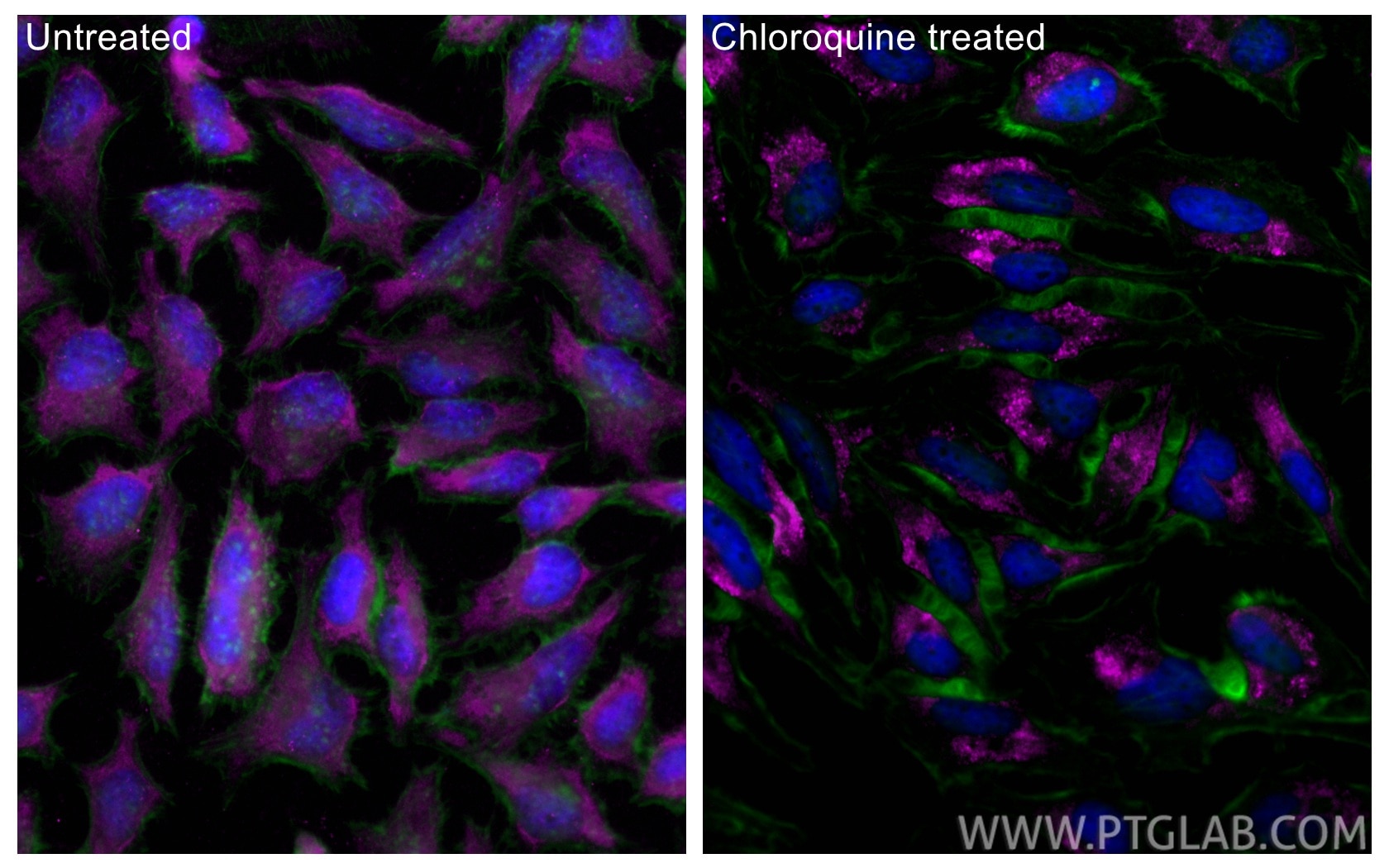 IF Staining of HeLa using CL647-18725 Immunofluorescence (IF) / fluorescent staining of HeLa cells using CoraLite® Plus 647-conjugated LC3B-Specific Polycl (CL647-18725)