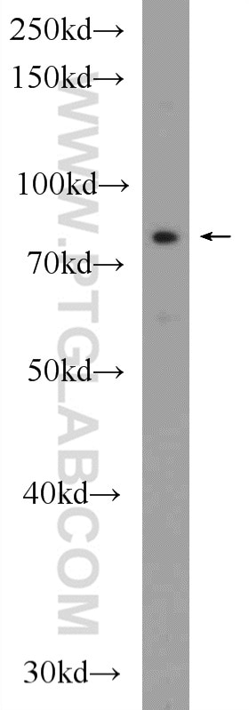 Western Blot (WB) analysis of HeLa cells using LCA5 Polyclonal antibody (19333-1-AP)