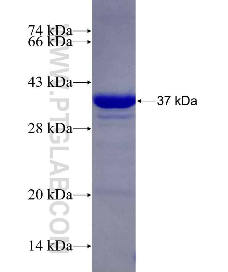 LCA5 fusion protein Ag5140 SDS-PAGE