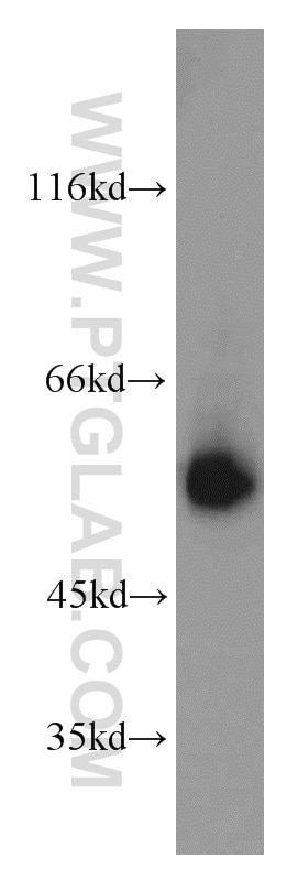 Western Blot (WB) analysis of HeLa cells using LCAT Polyclonal antibody (12243-1-AP)
