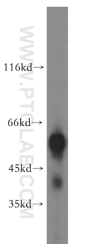 Western Blot (WB) analysis of PC-3 cells using LCAT Polyclonal antibody (12243-1-AP)