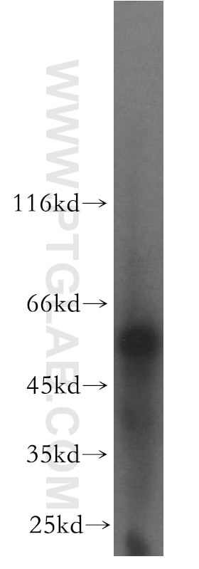Western Blot (WB) analysis of mouse bladder tissue using LCAT Polyclonal antibody (12243-1-AP)