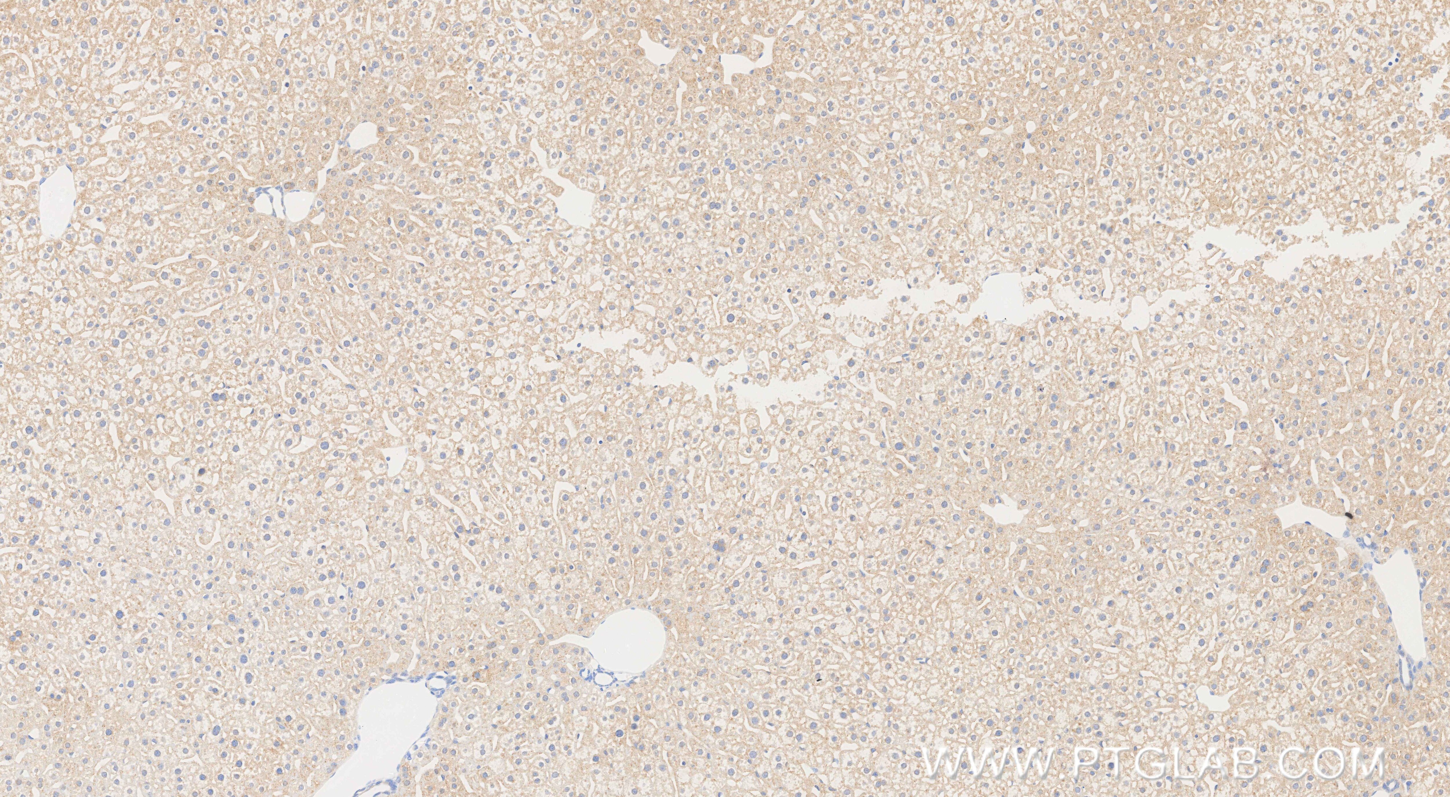Immunohistochemistry (IHC) staining of mouse liver tissue using LCAT Recombinant monoclonal antibody (86041-1-RR)