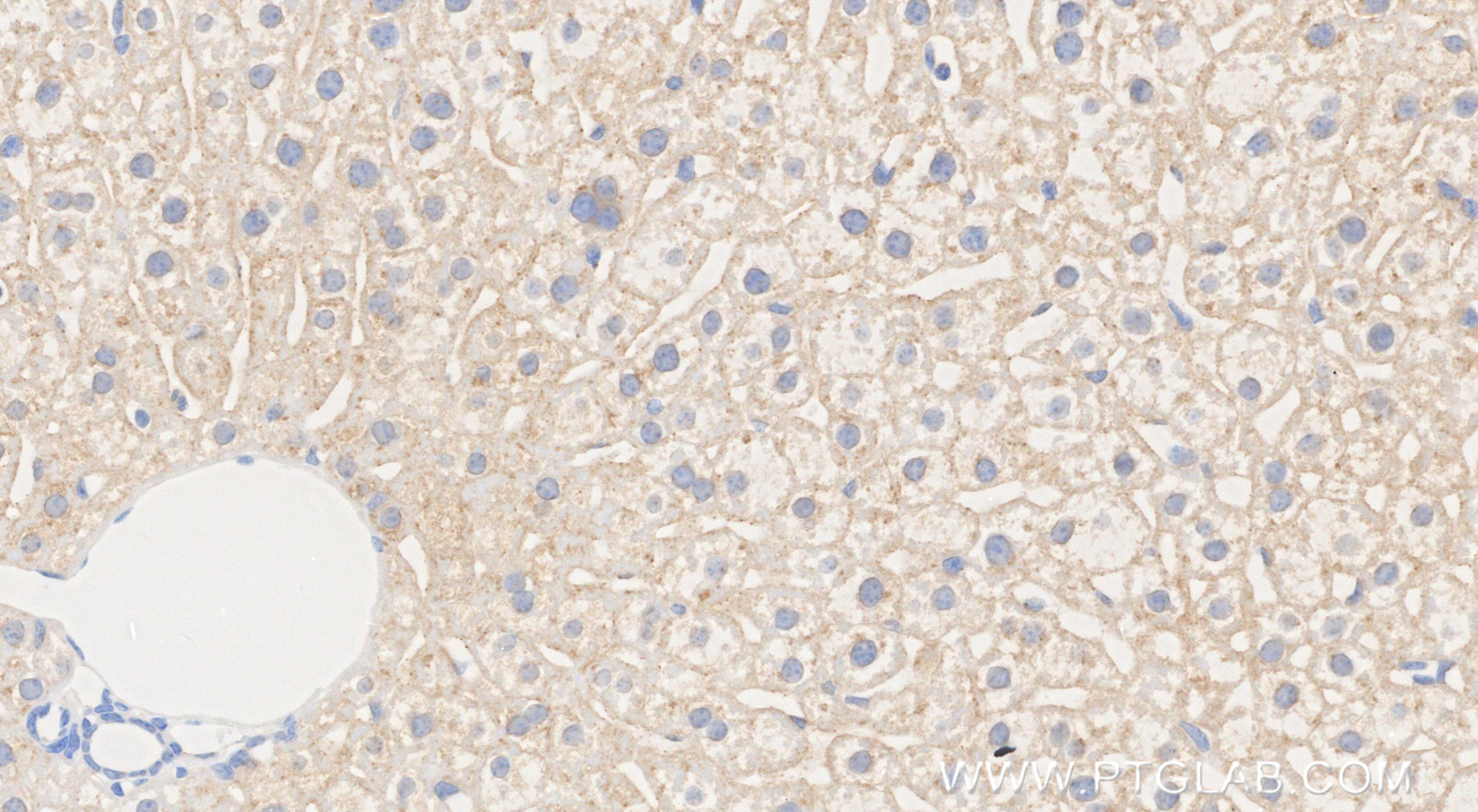 Immunohistochemistry (IHC) staining of mouse liver tissue using LCAT Recombinant monoclonal antibody (86041-1-RR)