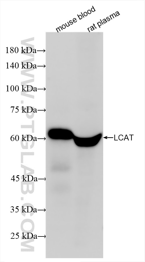 Western Blot (WB) analysis of various lysates using LCAT Recombinant antibody (86041-1-RR)
