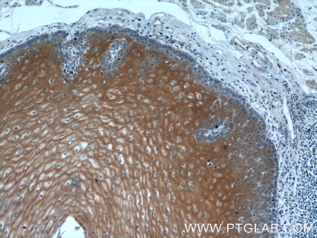 Immunohistochemistry (IHC) staining of human oesophagus tissue using LCE1A Polyclonal antibody (24956-1-AP)