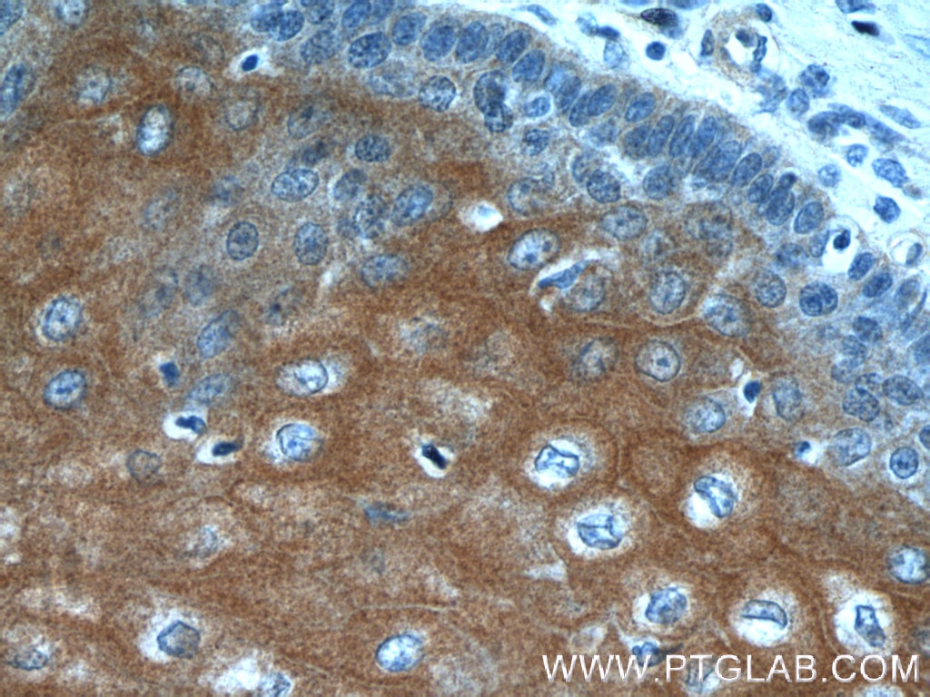 Immunohistochemistry (IHC) staining of human oesophagus tissue using LCE1A Polyclonal antibody (24956-1-AP)
