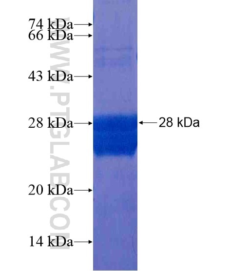 LCE1A fusion protein Ag21047 SDS-PAGE