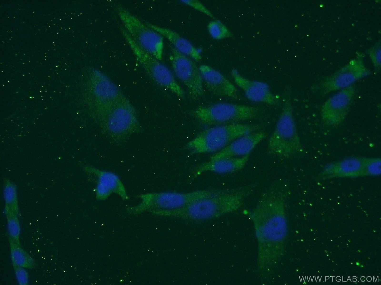 Immunofluorescence (IF) / fluorescent staining of A375 cells using LCE1B Polyclonal antibody (21771-1-AP)