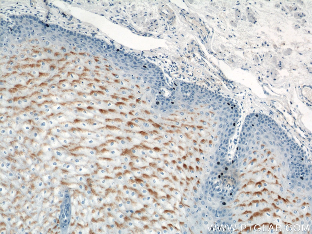 IHC staining of human oesophagus using 21771-1-AP