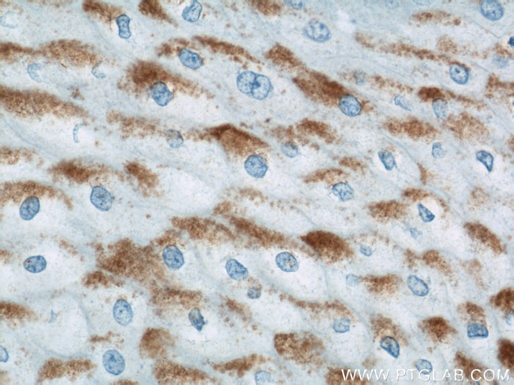 Immunohistochemistry (IHC) staining of human oesophagus tissue using LCE1B Polyclonal antibody (21771-1-AP)