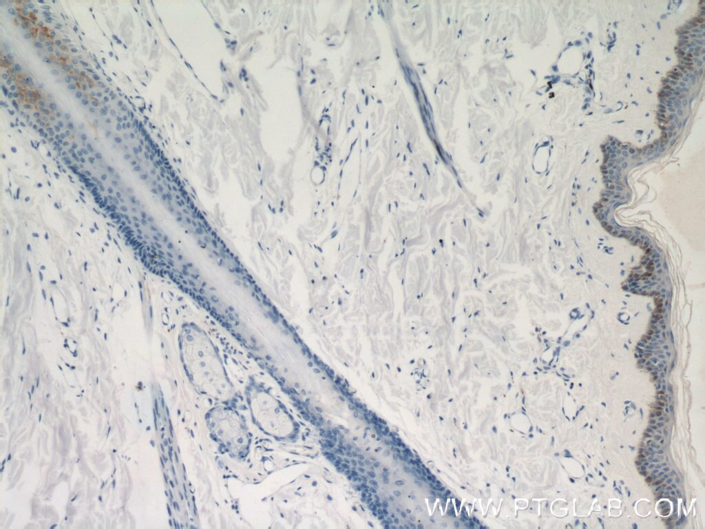 Immunohistochemistry (IHC) staining of human skin tissue using LCE1B Polyclonal antibody (21771-1-AP)