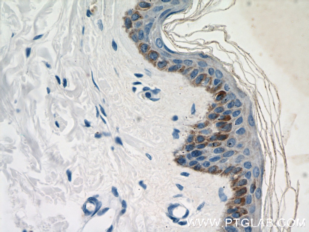 Immunohistochemistry (IHC) staining of human skin tissue using LCE1B Polyclonal antibody (21771-1-AP)