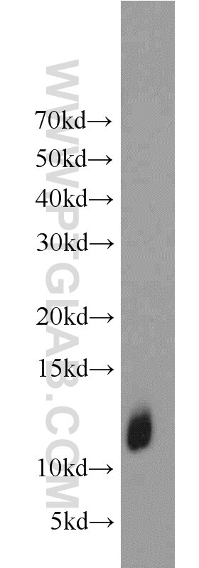 Western Blot (WB) analysis of A375 cells using LCE1B Polyclonal antibody (21771-1-AP)