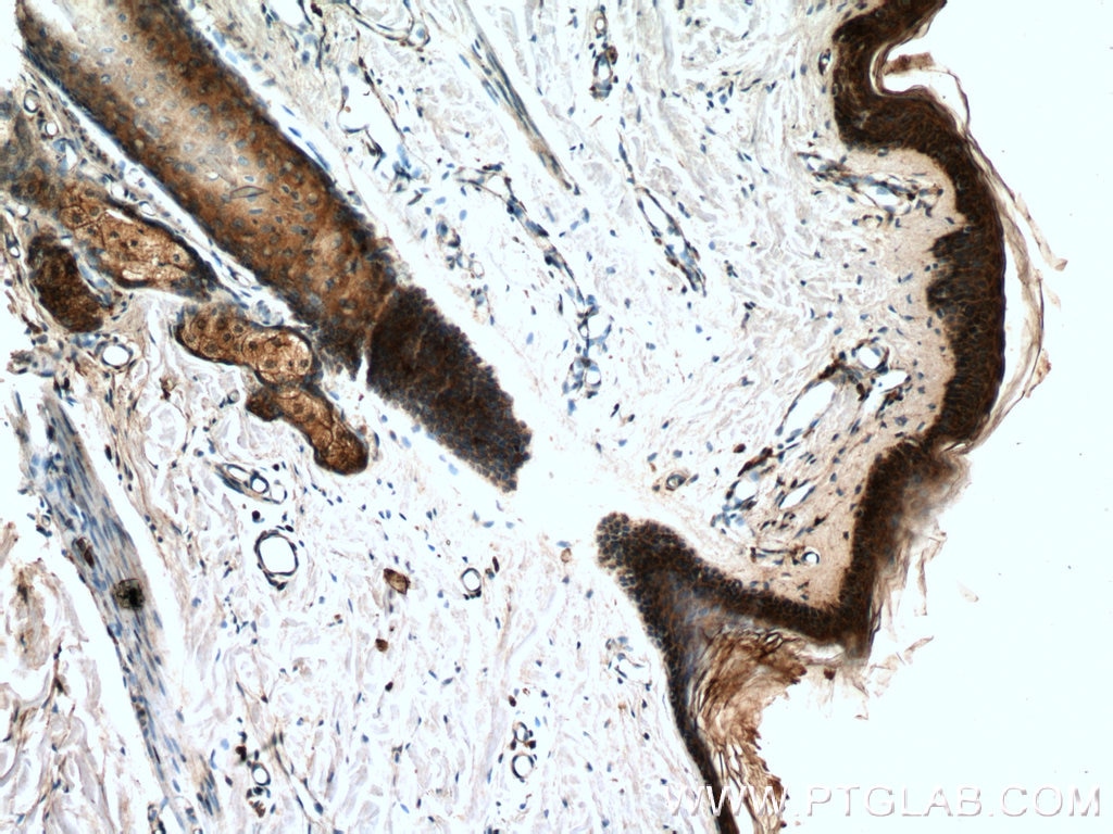 Immunohistochemistry (IHC) staining of human skin tissue using LCE2B Polyclonal antibody (26512-1-AP)