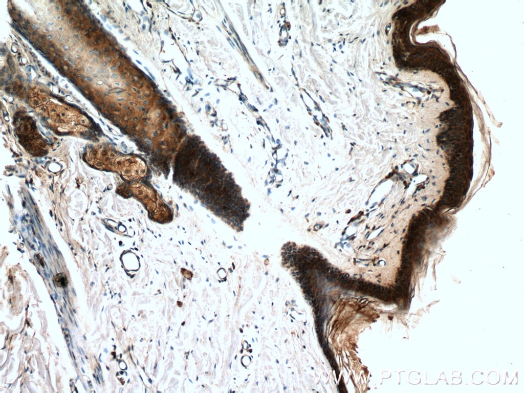 IHC staining of human skin using 26512-1-AP