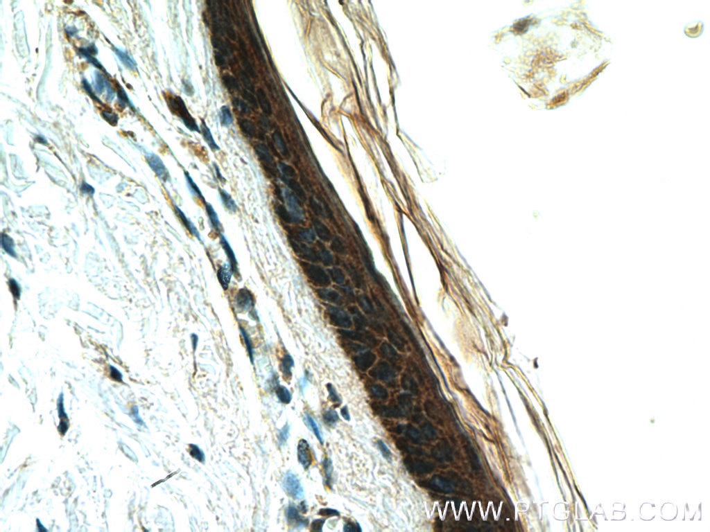 Immunohistochemistry (IHC) staining of human skin tissue using LCE2B Polyclonal antibody (26512-1-AP)