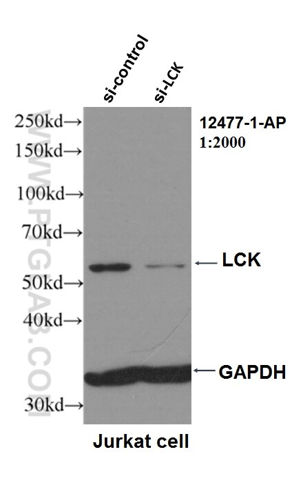 Western Blot (WB) analysis of Jurkat cells using LCK Polyclonal antibody (12477-1-AP)